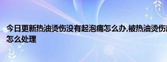 今日更新热油烫伤没有起泡痛怎么办,被热油烫伤起水泡应该怎么处理