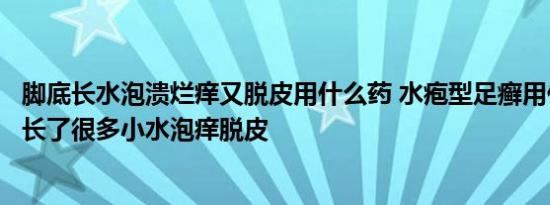 脚底长水泡溃烂痒又脱皮用什么药 水疱型足癣用什么药脚上长了很多小水泡痒脱皮 