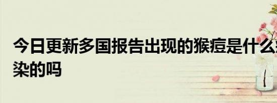 今日更新多国报告出现的猴痘是什么疾病会传染的吗