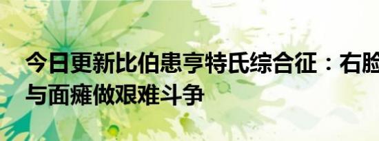 今日更新比伯患亨特氏综合征：右脸面瘫 正与面瘫做艰难斗争