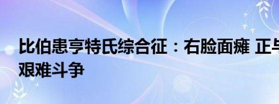 6月10日更新 比伯患亨特氏综合征：右脸面瘫 正与面瘫做艰难斗争