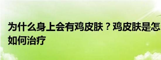 为什么身上会有鸡皮肤？鸡皮肤是怎么引起的如何治疗