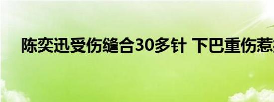 陈奕迅受伤缝合30多针 下巴重伤惹担忧