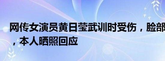 网传女演员黄日莹武训时受伤，脸部缝了7针，本人晒照回应