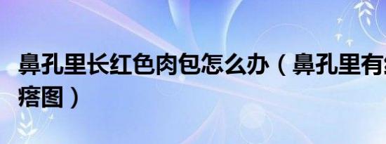 鼻孔里长红色肉包怎么办（鼻孔里有红色肉疙瘩图）