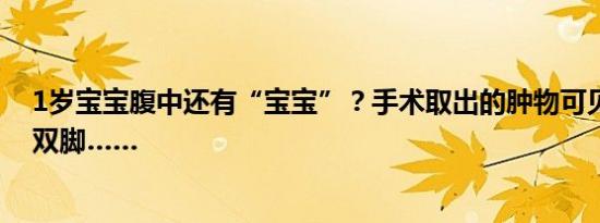 1岁宝宝腹中还有“宝宝”？手术取出的肿物可见完整双手双脚……